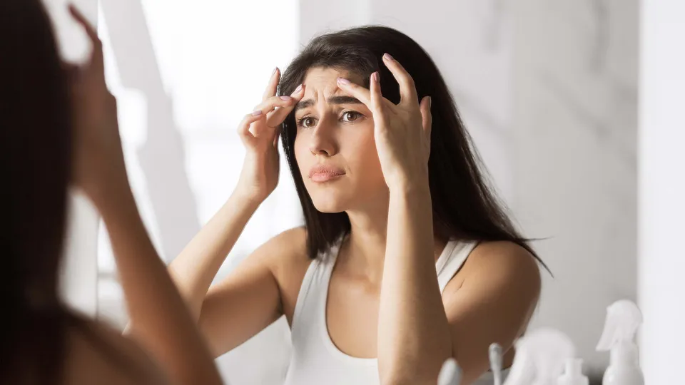 Bí quyết cải thiện tình trạng nếp nhăn trên trán